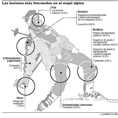 /upload/fotos/blogs_entradas/las_lesiones_ms_frecuentes_de_los_esquiadores.jpg