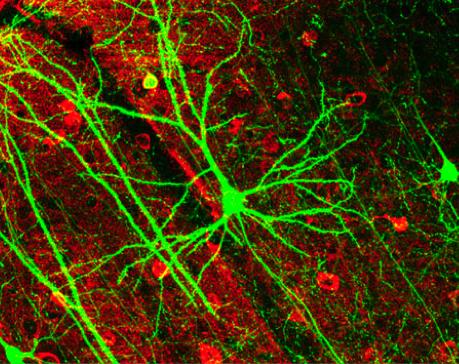 /upload/fotos/blogs_entradas/neuronas1_med.jpg